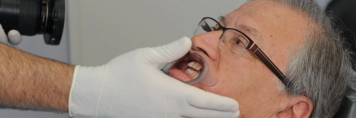 Hollywood Adjusting to New Dentures