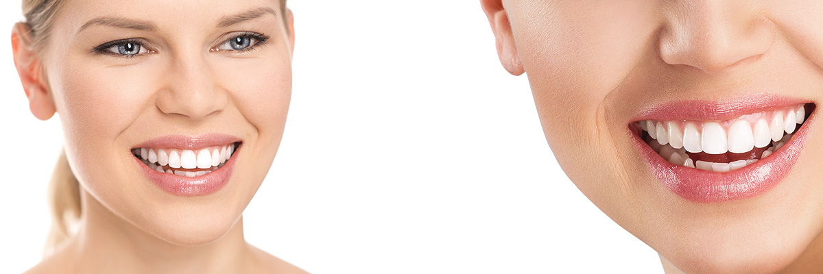 Hollywood Cosmetic Dental Services