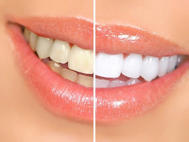 Vick Kargodorian, DDS