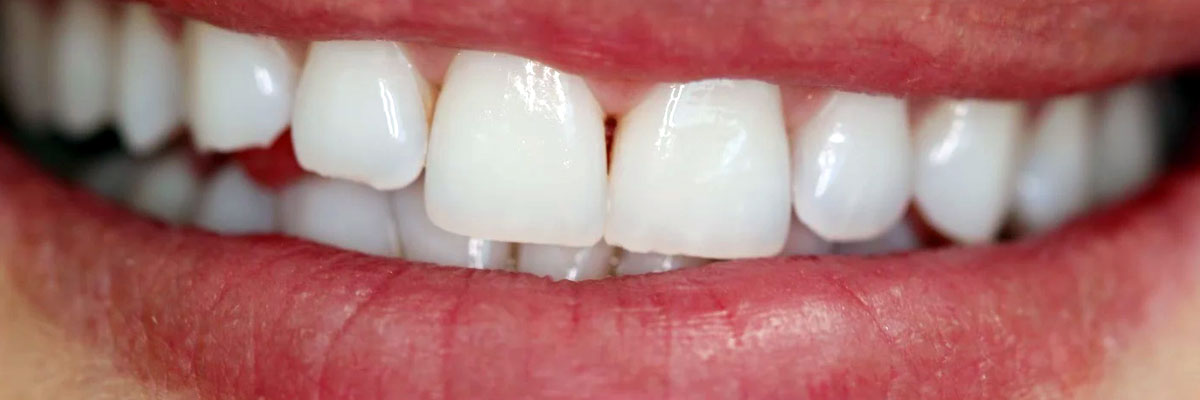 Hollywood Dental Checkup