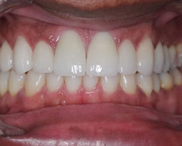 Dental Checkup