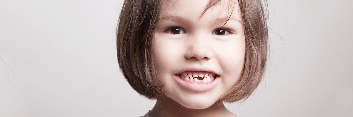Hollywood Dental Restoration