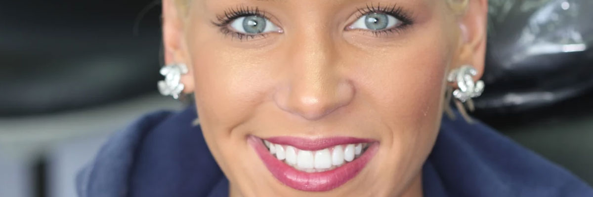 Hollywood Veneers