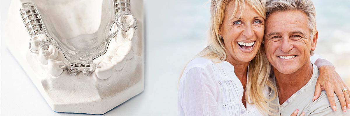 Hollywood Implant Supported Dentures
