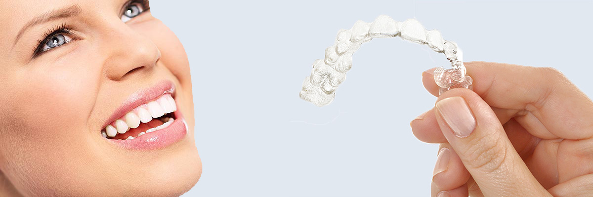 Hollywood 7 Things Parents Need to Know About Invisalign Teen