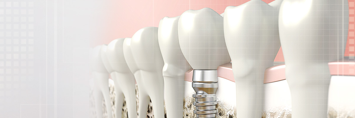 Hollywood Oral Prosthetics Doctor