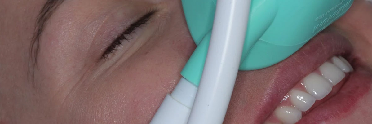 Hollywood Sedation Dentist