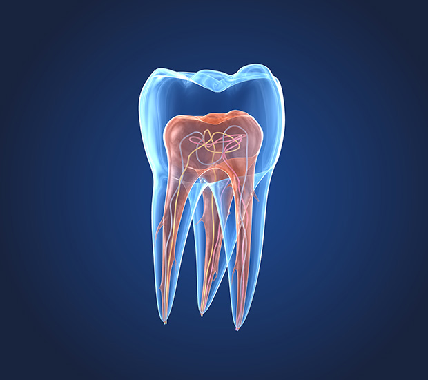 Hollywood What is an Endodontist